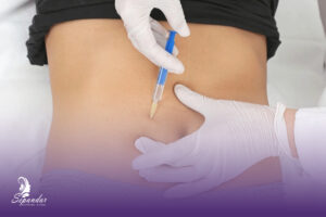 فردی که در حال انجام عمل بوتاکس معده است و پزشک در حال تزریق است.