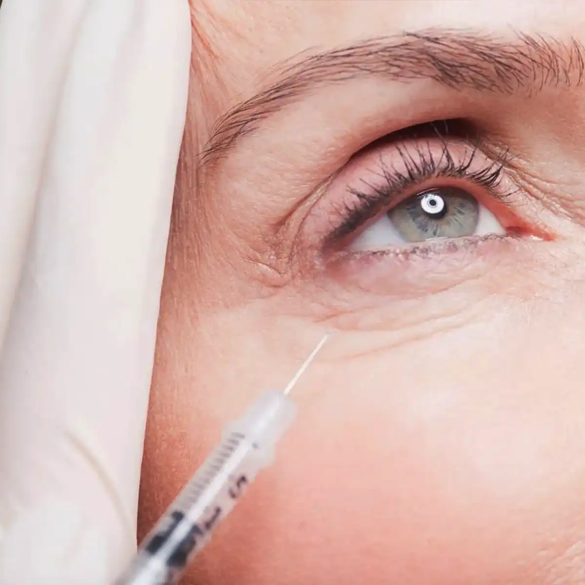 -تزریق کلاژن زیر چشم