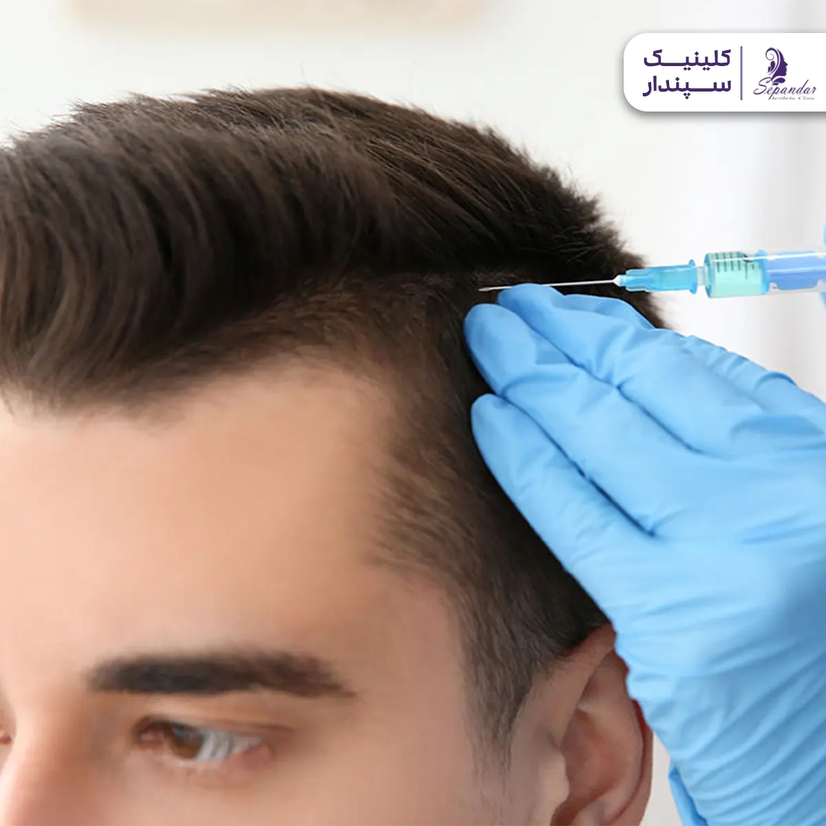 عکس از سر یک مرد که یک سرنگ حاوی مواد درمان مزوتراپی در حال تزریق به آن است