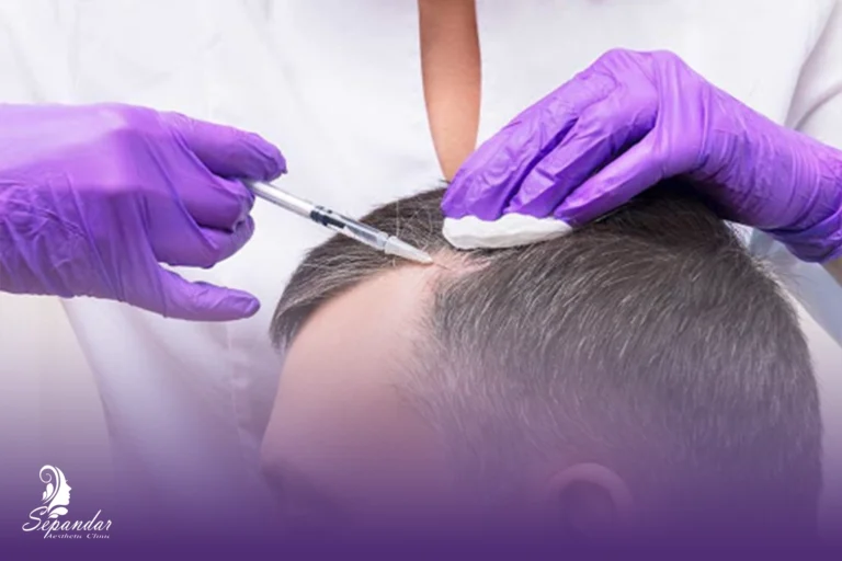 عکس از یک فرد در حال انجام اگزوزوم تراپی مو