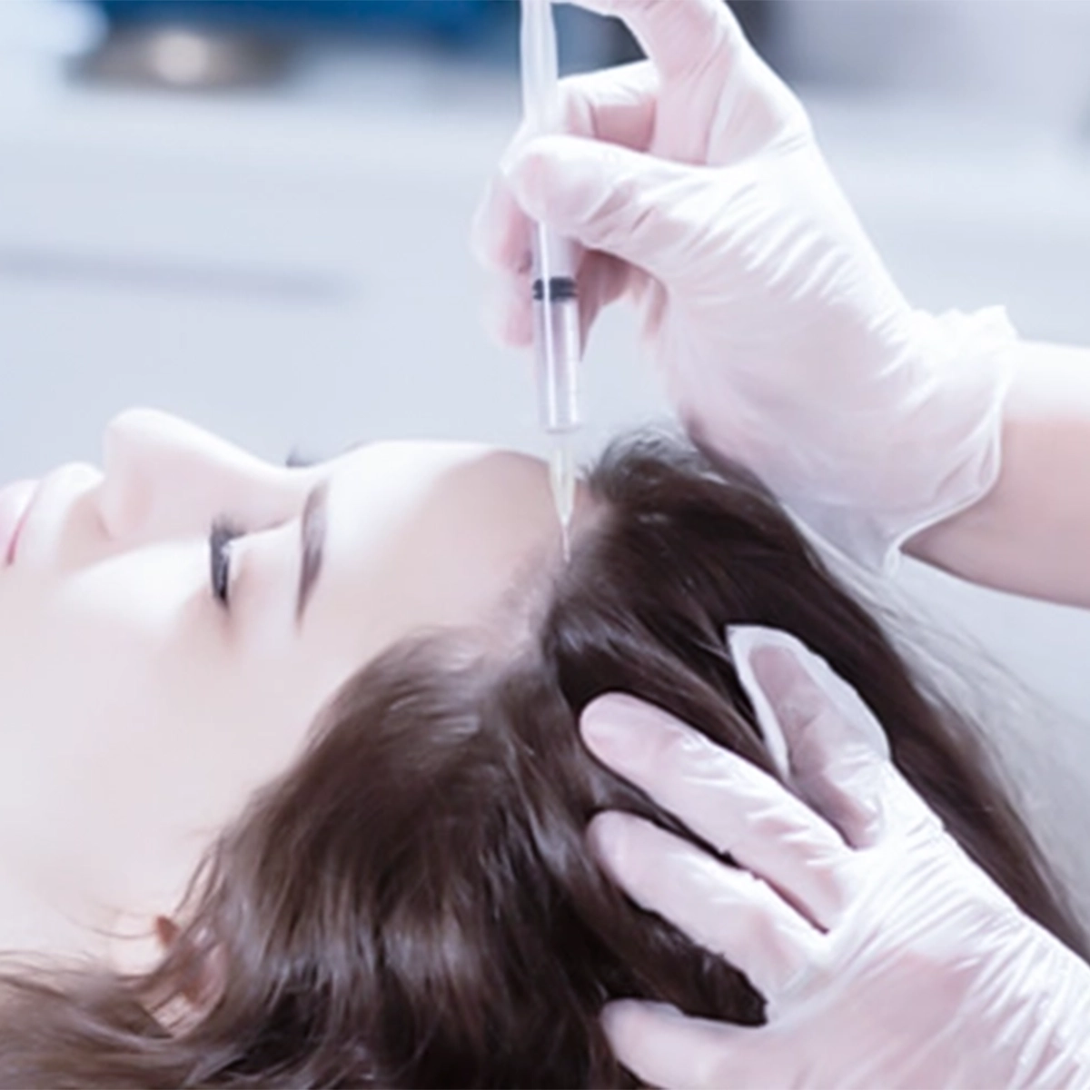 فردی در حال تزریق کوکتل های مزو و انجام مزوتراپی برای مو