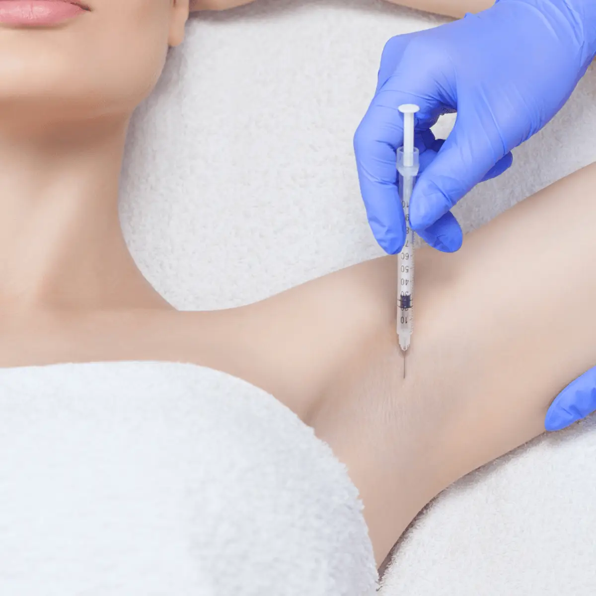 تزریق بوتاکس زیر بغل در کلینیک دکتر سپندار مشهد