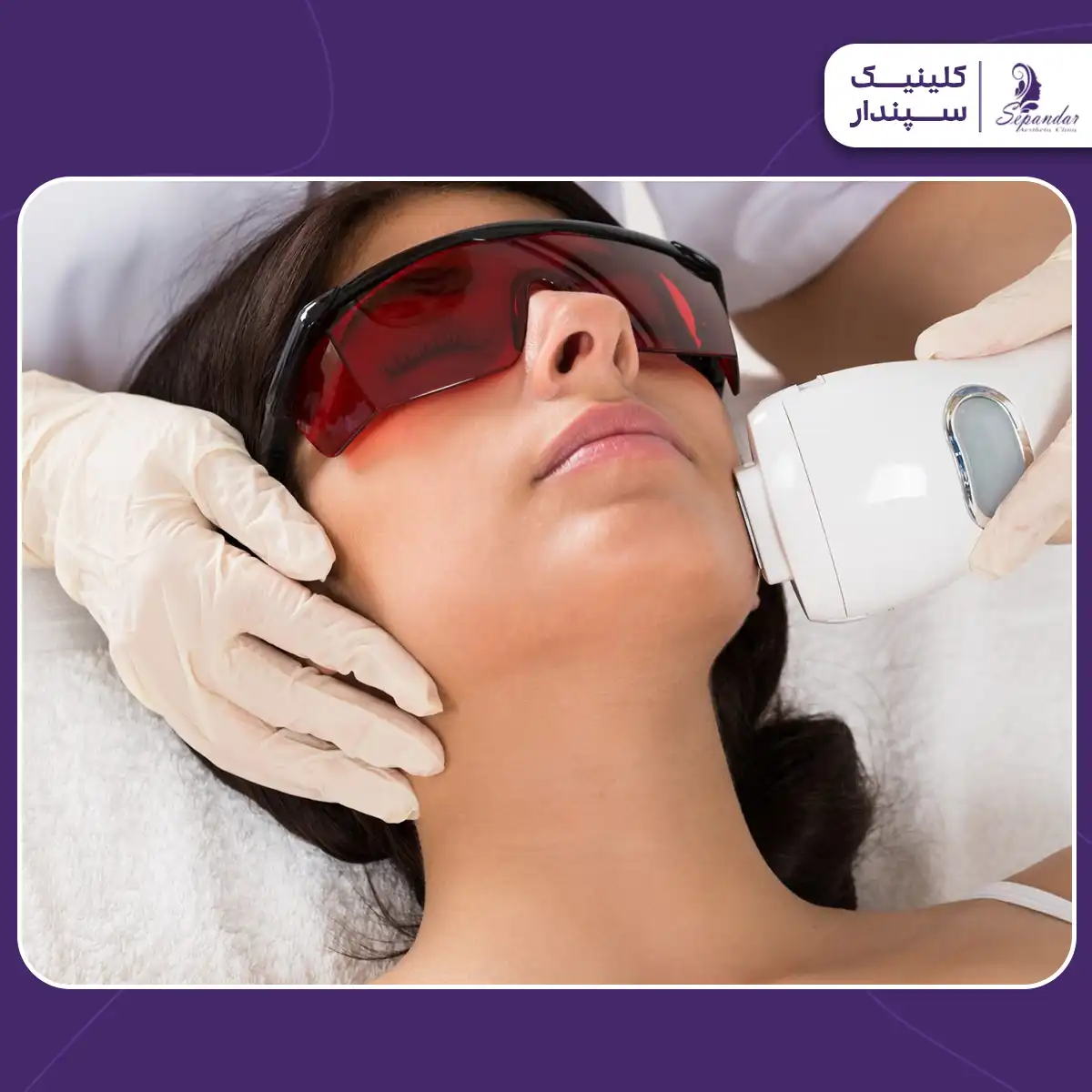 خانمی که دراز کشیده و چشم هایش بسته است و اپراتور در حال لیزر کردن موهای زائد صورتش است