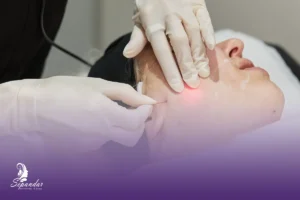 صورت فردی که پزشک در حال انجام لیزر اندولیفت بر روی آن است.