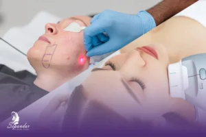 تصویری که دو روش محبوب جوانسازی پوست یعنی اندولیفت و هایفوتراپی را در کنار یکدیگر نشان می‌دهد