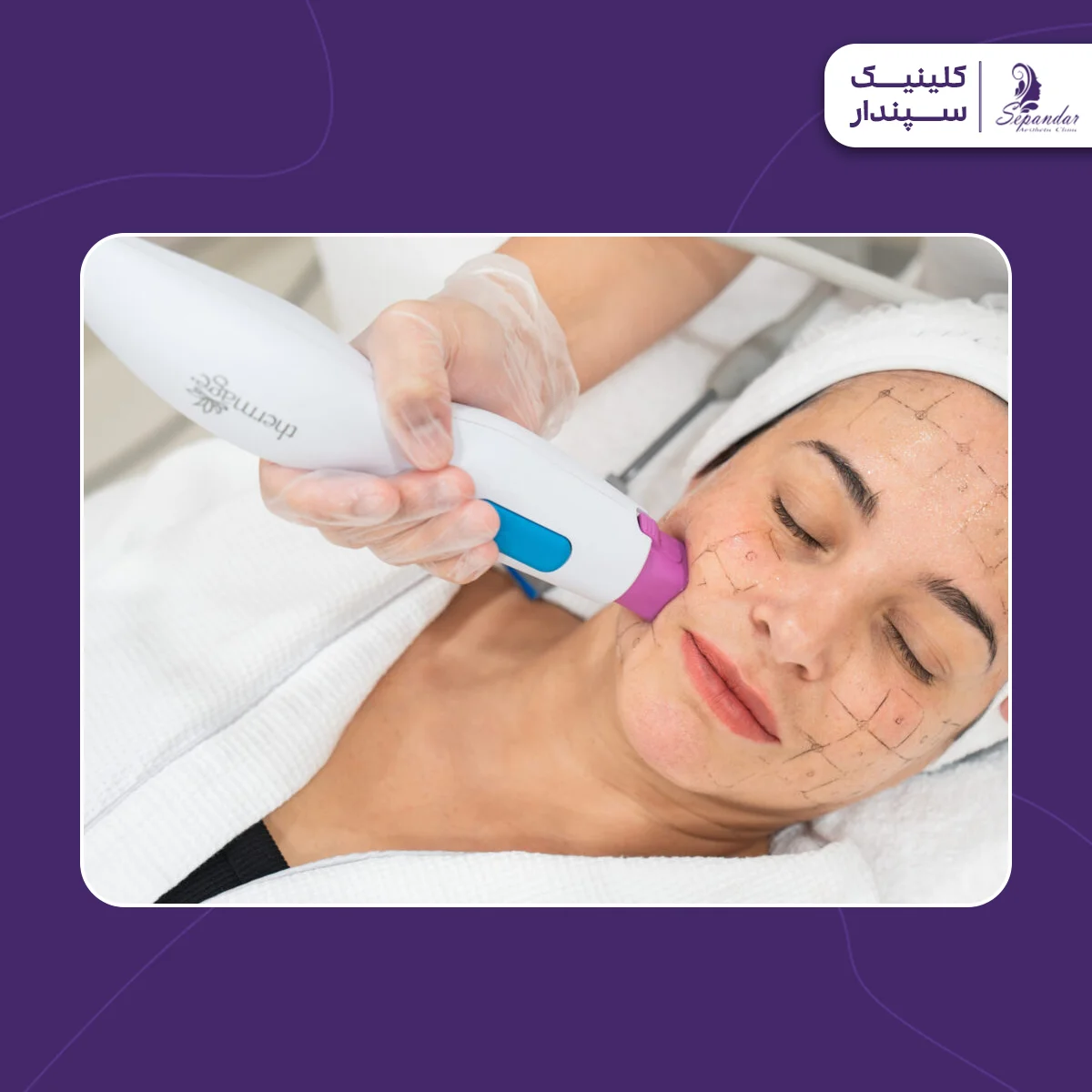 خانمی که در حال انجام ترماژ صورت است