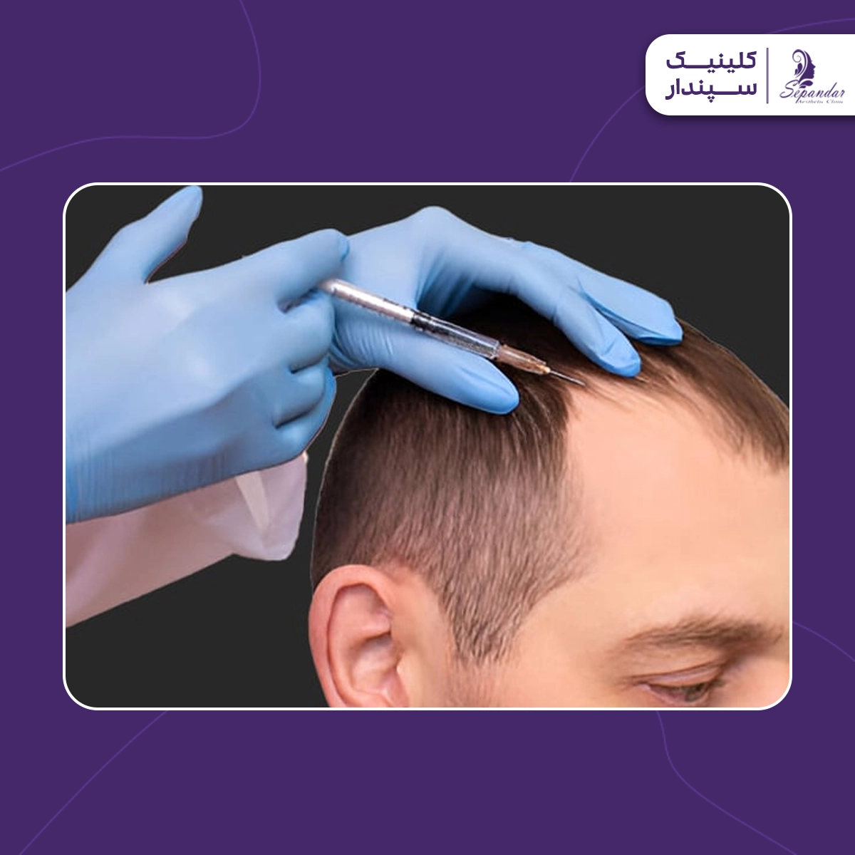 فردی در حال تزریق هیر فیلر