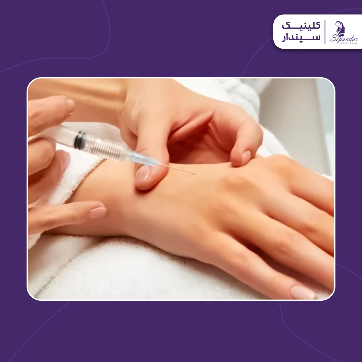 فردی که در حال تزریق بوتاکس به دستش برای جوانسازی است